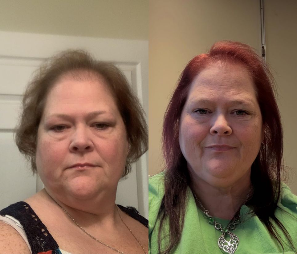 La-Celsa Hair Grow Spray