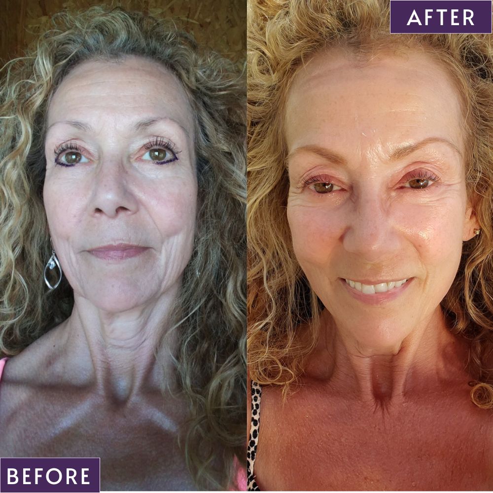La-Celsa™ Vibriance Serum
