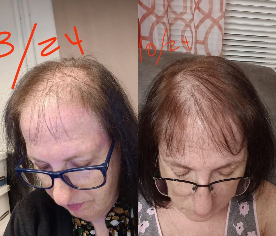 La-Celsa Hair Grow Spray