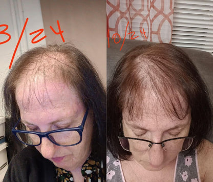 La-Celsa Hair Grow Spray